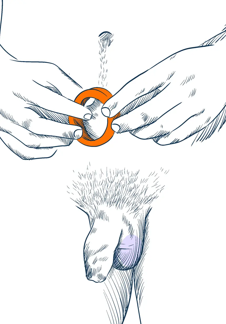 Un anneau en silicone posé à côté d'une main, testicules en position basse.